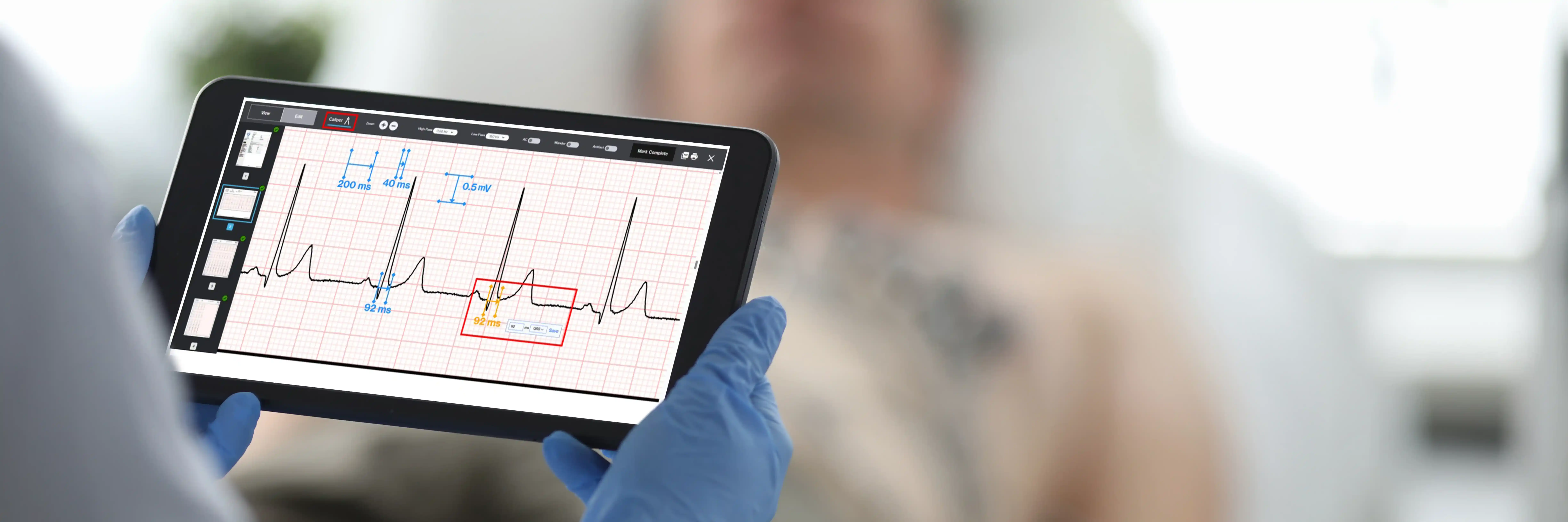 Medical professional reviewing ECG waveforms on tablet