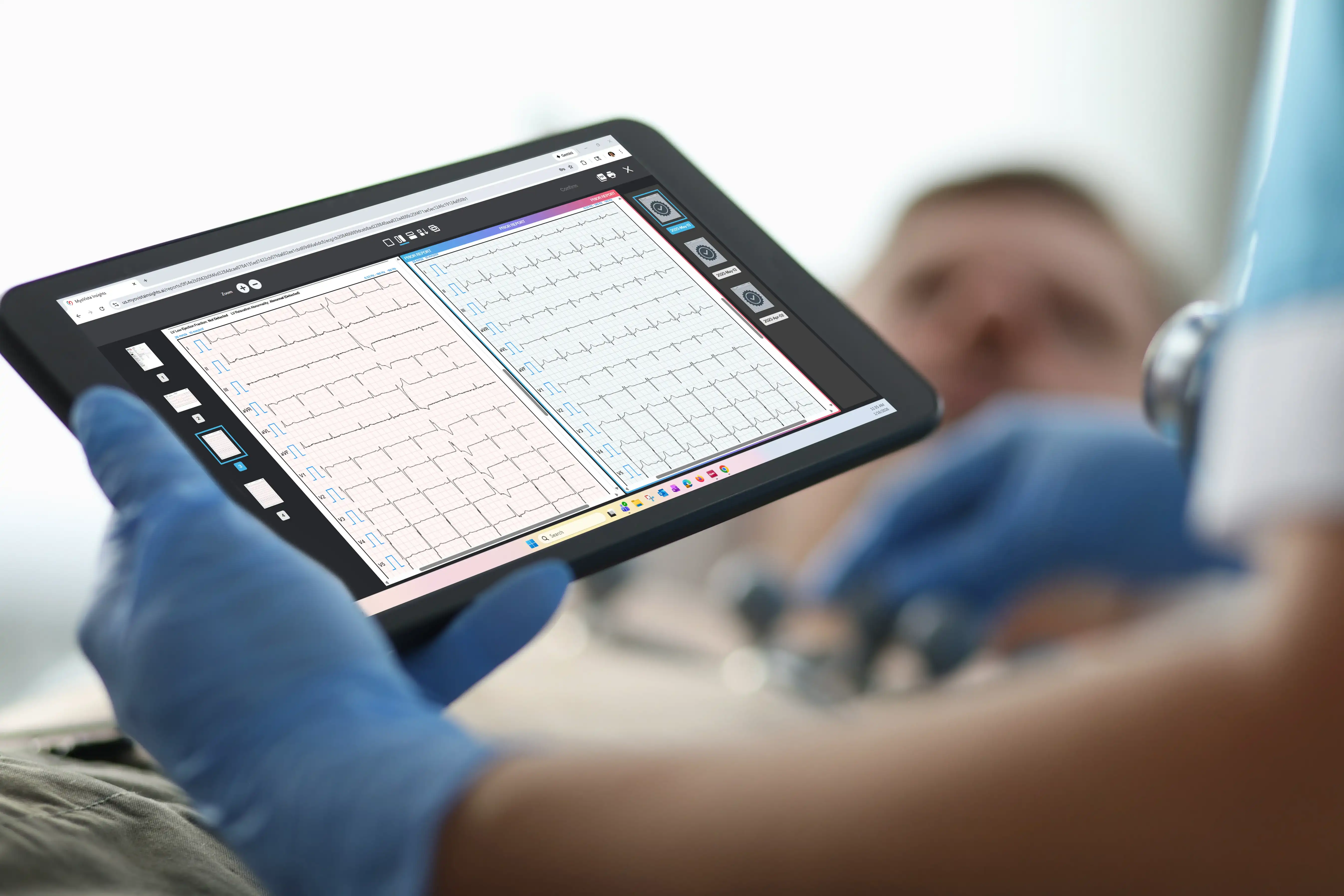 MyoVista® Insights™ Platform - Physician using AI-ECG analysis